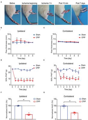 Electroacupuncture Ameliorates Mechanical Allodynia of a Rat Model of CRPS-I via Suppressing NLRP3 Inflammasome Activation in Spinal Cord Dorsal Horn Neurons